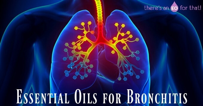 Essential oils for healing bronchitis.