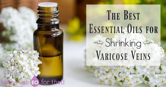 The Best Essential Oils for Shrinking Varicose Veins