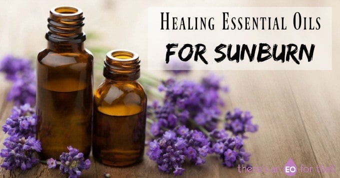 Healing Essential Oils for Sunburn