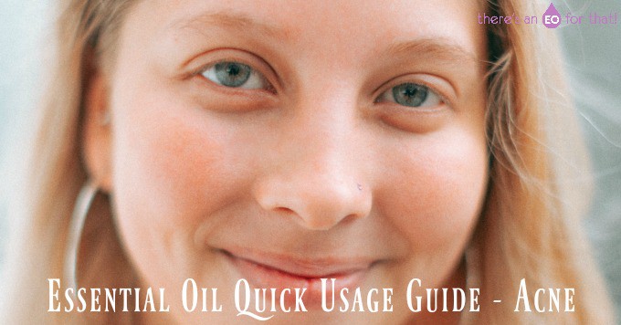 Essential Oil Quick Usage Guide - Acne