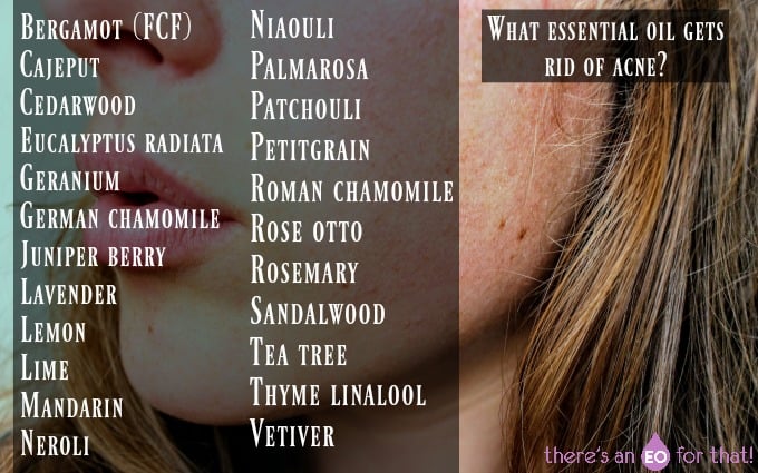 What essential oil gets rid of acne?